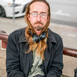 Cabellos blancos: ¿Por qué amarillean?